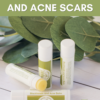 Blackheads and Acne Balm - Image 7
